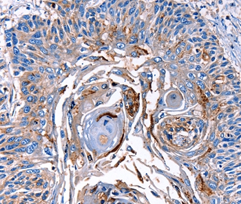 LRP2 Antibody