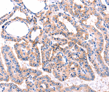 ADRBK1 Antibody