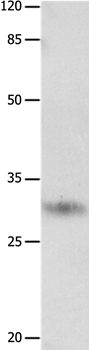 KLK2 Antibody