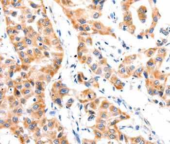 PAFAH1B1 Antibody