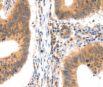 LRPPRC Antibody
