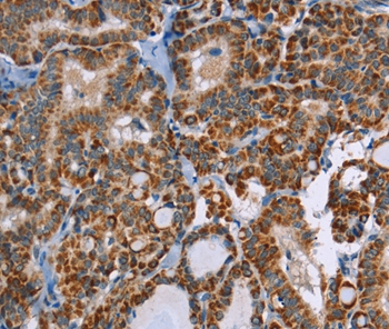 ABCB1 Antibody