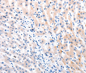 MTOR Antibody