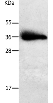 PPAP2A Antibody