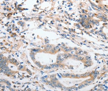 SLC15A2 Antibody