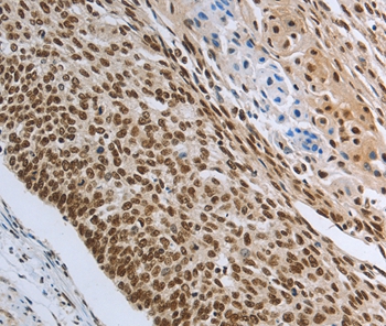 PRMT3 Antibody