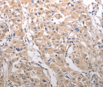 RAD52 Antibody