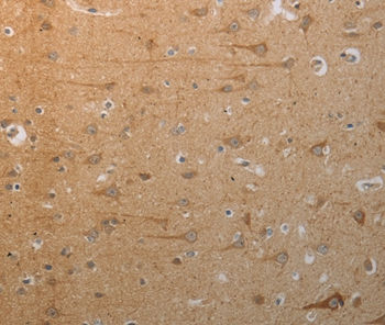 SLC4A7 Antibody