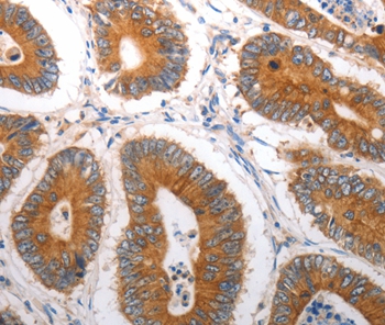 SLC12A6 Antibody
