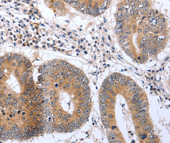 PSPN Antibody