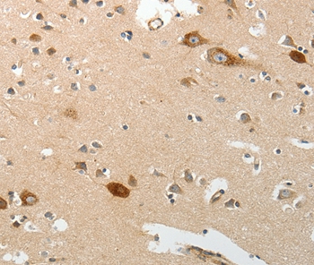 SREBF2 Antibody