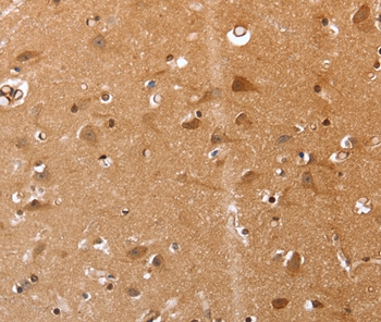 VIMP Antibody