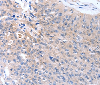 MAP3K4 Antibody