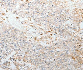 TNC Antibody