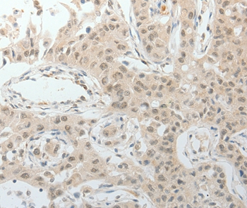 TOP1MT Antibody