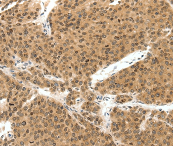 TERF2 Antibody
