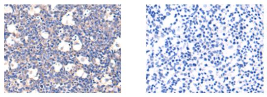 TMSB10 Antibody