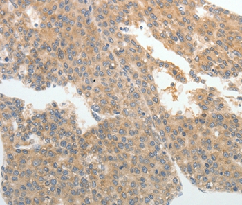 ABCB11 Antibody