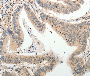 ADAMTS2 Antibody