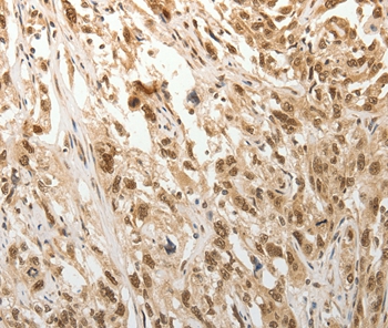 ADIPOR2 Antibody