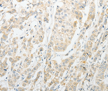 AGBL1 Antibody
