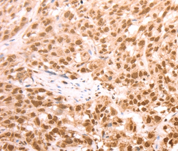 AMD1 Antibody