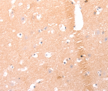 AMH Antibody