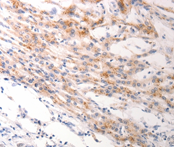 KRT6B Antibody