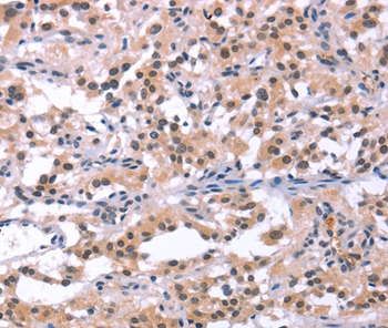 ORAI1 Antibody