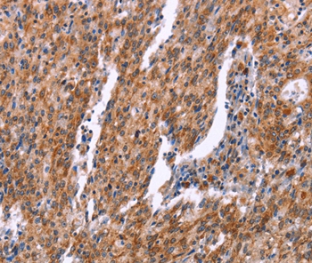 RPS6KA6 Antibody