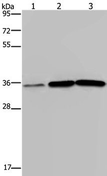 MAGEA3 Antibody