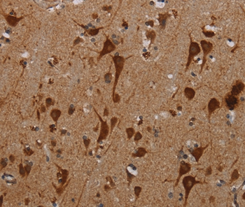 KMT2D Antibody