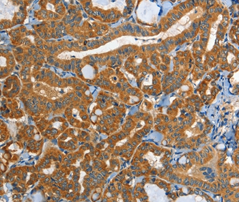 EPHB3 Antibody