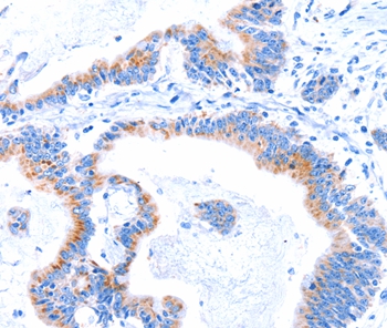 SMG8 Antibody