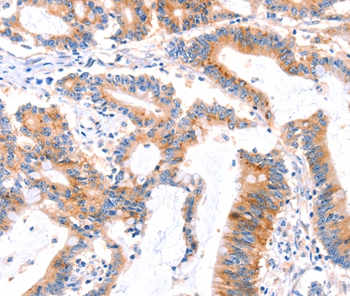 MLLT4 Antibody
