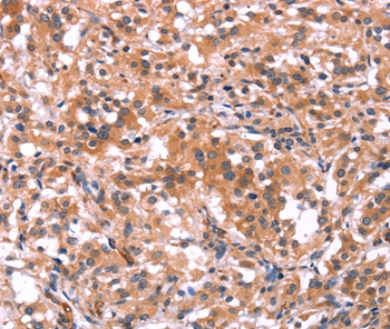 BCR Antibody