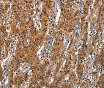 CD163 Antibody