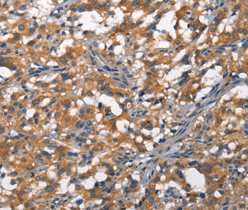 DDR2 Antibody