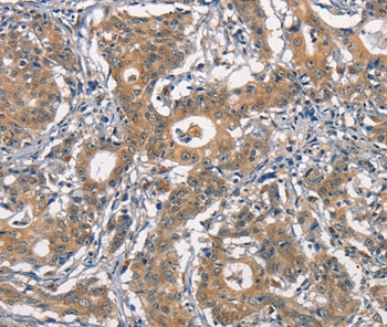 CR2 Antibody
