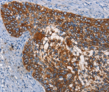 CD68 Antibody
