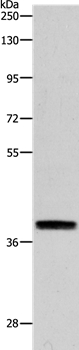 RTN4 Antibody