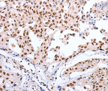 POU3F1 Antibody