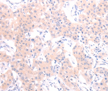 HCRT Antibody