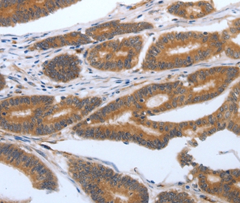 PODXL Antibody
