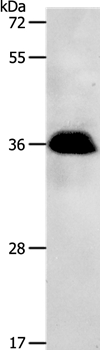 PPP2CB Antibody