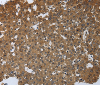 PTPRM Antibody