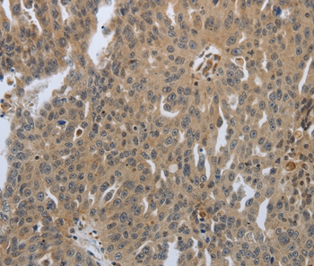 PTPRT Antibody