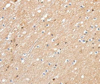 RRAD Antibody