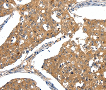 SCN5A Antibody
