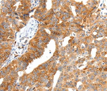 SCT Antibody
